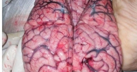 Beyin yaklak 1,5 kg'lk bir arla sahiptir. 